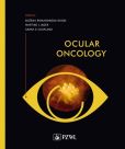 Ocular oncology Ocular oncology