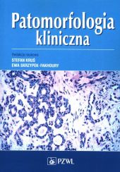 Patomorfologia kliniczna Patomorfologia kliniczna