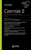 Czerniak. Współczesne podejście 2 Czerniak. Współczesne podejście 2
