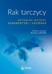 Rak tarczycy Aktualne metody diagnostyki i leczenia Rak tarczycy Aktualne metody diagnostyki i leczenia