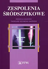 Zespolenia śródszpikowe Zespolenia śródszpikowe