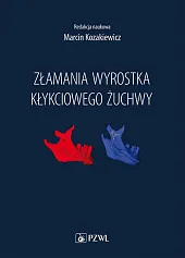 Złamania wyrostka kłykciowego żuchwyMarcin Kozakiewicz
