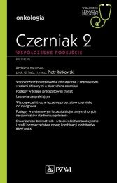 Czerniak. Współczesne podejście 2 Czerniak. Współczesne podejście 2