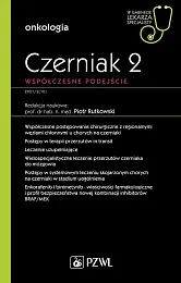 Czerniak. Współczesne podejście 2Piotr Rutkowski