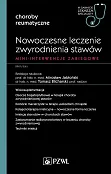 Nowoczesne leczenie zwyrodnienia stawów. Mini-interwencje zabiegowe Nowoczesne leczenie zwyrodnienia stawów. Mini-interwencje zabiegowe