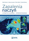 Zapalenia naczyń w praktyce klinicznej interdyscyplinarnie