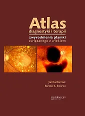 Atlas diagnostyki i terapii zwyrodnienia plamki,Jan Kucharczuk