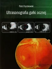 Ultrasonografia gałki ocznejPiotr Fryczkowski