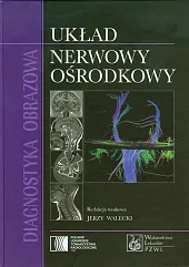 Diagnostyka obrazowa Układ nerwowy ośrodkowyJerzy Walecki