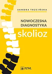 Nowoczesna diagnostyka skoliozSandra Trzcińska