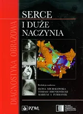 Diagnostyka obrazowa Serce i duże naczyniaIlona Michałowska Diagnostyka obrazowa Serce i duże naczyniaIlona Michałowska