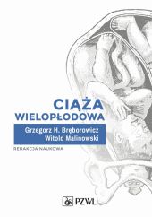 Ciąża wielopłodowa Ciąża wielopłodowa