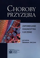 Choroby przyzębiaZbigniew Jańczuk Choroby przyzębiaZbigniew Jańczuk