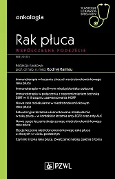 Rak płuca Współczesne podejście Rak płuca Współczesne podejście