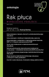 Rak płuca Współczesne podejścieRodryg Ramlau Rak płuca Współczesne podejścieRodryg Ramlau