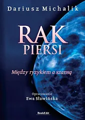Rak piersiDariusz Michalik