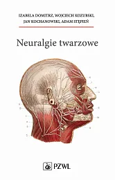 Neuralgie twarzoweIzabela Domitrz Neuralgie twarzoweIzabela Domitrz