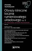 Obrazy kliniczne tocznia rumieniowatego układowego Część 2 Obrazy kliniczne tocznia rumieniowatego układowego Część 2