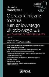 Obrazy kliniczne tocznia rumieniowatego układowego Część,Maria Majdan Obrazy kliniczne tocznia rumieniowatego układowego Część,Maria Majdan