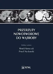 Przerzuty nowotworowe do wątrobyMarek Krawczyk Przerzuty nowotworowe do wątrobyMarek Krawczyk