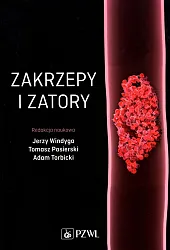 Zakrzepy i zatoryJerzy Windyga