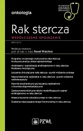Rak stercza Współczesne spojrzeniePaweł Wiechno