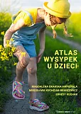 Atlas wysypek u dzieci