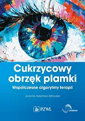 Cukrzycowy obrzęk plamki.Joanna Adamiec-Mroczek Cukrzycowy obrzęk plamki.Joanna Adamiec-Mroczek
