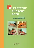 Alergiczne choroby oczu Alergiczne choroby oczu