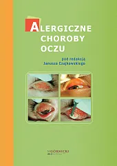Alergiczne choroby oczuEwa Bogacka Alergiczne choroby oczuEwa Bogacka