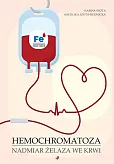 Hemochromatoza Nadmiar żelaza we krwi