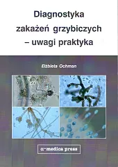 Diagnostyka zakażeń grzybiczych - uwagi praktykaElżbieta Ochman