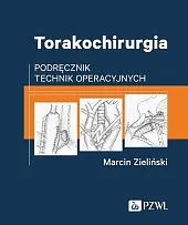 TorakochirurgiaMarcin Zieliński TorakochirurgiaMarcin Zieliński