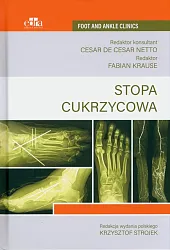 Stopa cukrzycowaKrzysztof Strojek