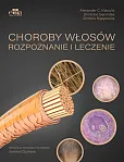 Choroby włosów. Rozpoznanie i leczenie