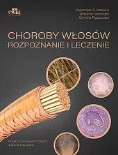 Choroby włosów. Rozpoznanie i leczenieAlexander C. Katoulis