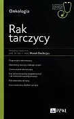 Rak tarczycy
