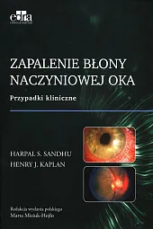 Zapalenie błony naczyniowej oka