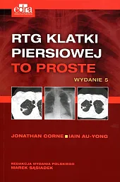 RTG klatki piersiowej To prosteM.Sąsiadek 