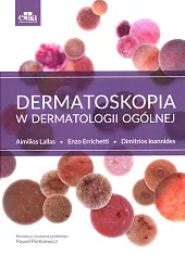 Dermatoskopia w dermatologii ogólnej