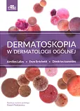 Dermatoskopia w dermatologii ogólnej
