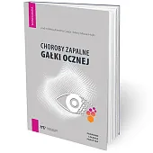 Choroby zapalne gałki ocznej - poradnik,Karolina Czajor Choroby zapalne gałki ocznej - poradnik,Karolina Czajor