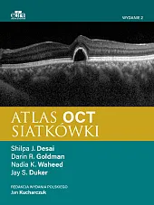 Atlas OCT siatkówkiJ.Kucharczuk 