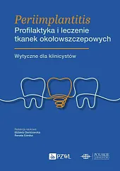 Periimplantitis Profilaktyka i leczenie tkanek okołowszczepowychElżbieta Dembowska