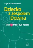 Dziecko z zespołem Downa Dziecko z zespołem Downa