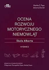 Ocena rozwoju motorycznego niemowląt. Skala Alberta