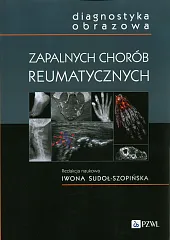 Diagnostyka obrazowa zapalnych chorób reumatycznychIwona Sudoł-Szopińska 