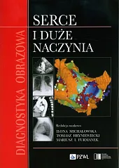 Diagnostyka obrazowa Serce i duże naczyniaIlona Michałowska Diagnostyka obrazowa Serce i duże naczyniaIlona Michałowska