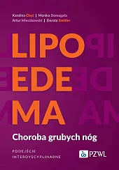 LipoedemaKarolina Chęś