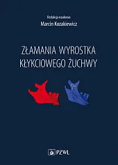Złamania wyrostka kłykciowego żuchwyMarcin Kozakiewicz